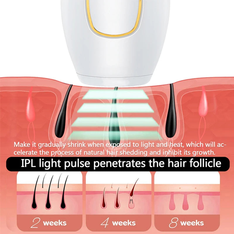Depilador a Laser IPL Profissional – Remoção de Pelos Permanente em Casa